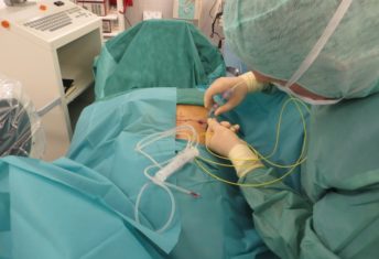 Laserová operace se provádí v lokální anestezii, zdroj: painclinic.sk